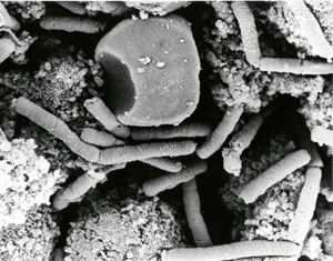 photo de la bacille du charbon